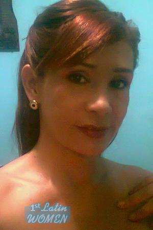 153461 - Grace Age: 50 - Colombia
