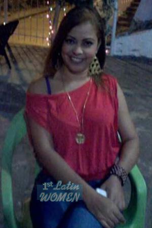 170304 - Claudit Age: 48 - Colombia